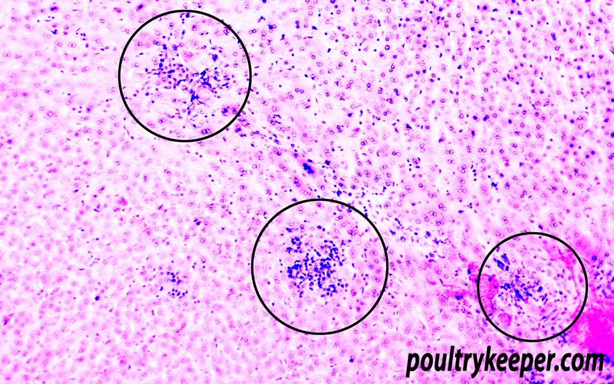 Coccidiosis